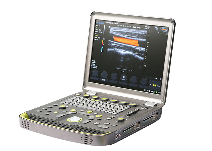 3D Color Doppler Laptop Ultrasound Scanner Triplex Synchronous Trapezoidal Imaging