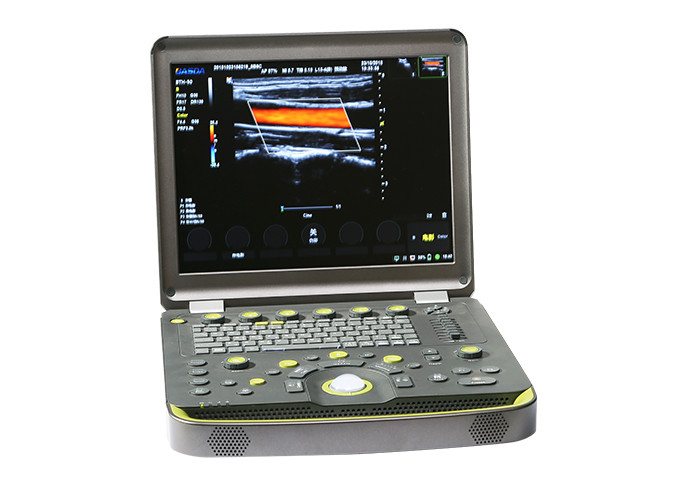 NMPA Andrology Doppler Ultrasound Machine 3D Color IMT BTH-50